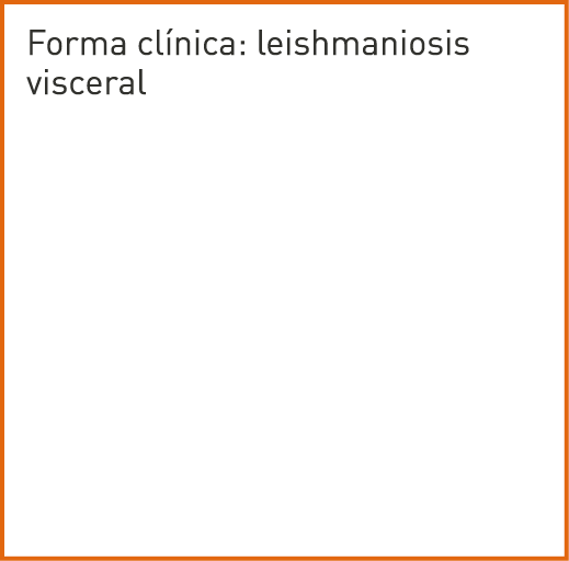Forma clínica: leishmaniosis visceral